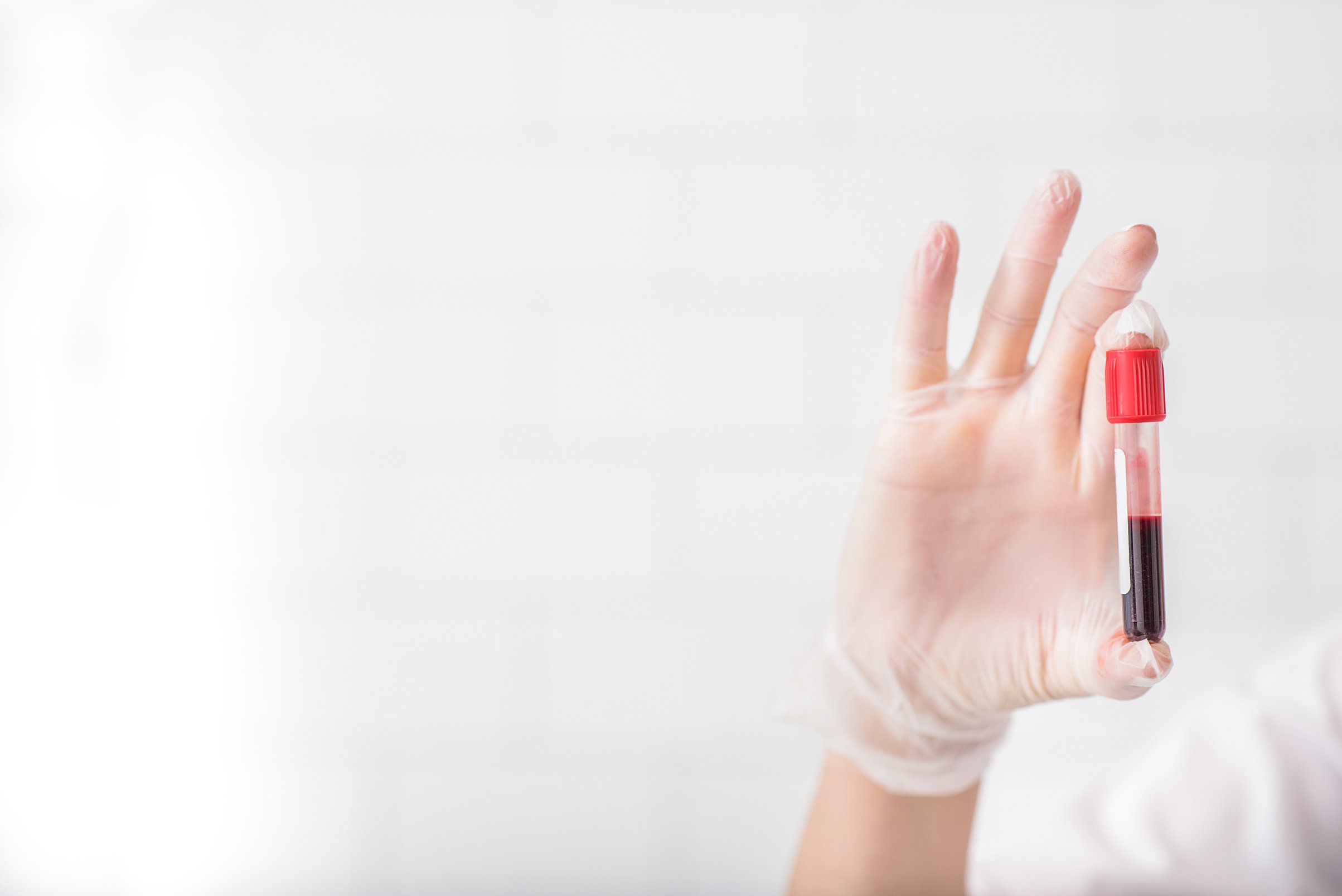 Scientist analyzing blood test tube